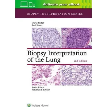 Biopsy Interpretation of the Lung (Biopsy Interpretation Series) - Suster, Saul