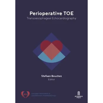 Perioperative TOE - Bouchez, Stefaan
