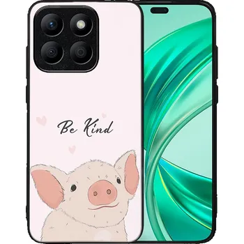 Pouzdro na tablet VSECHNONAMOBIL 83095 MY ART Ochranný kryt pro Honor X8b BE KIND (190)