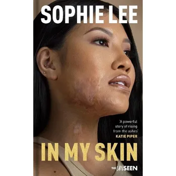 Kniha In My Skin - Lee, Sophie