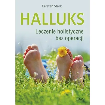Halluks. Leczenie holistyczne bez operacji - Carsten Stark