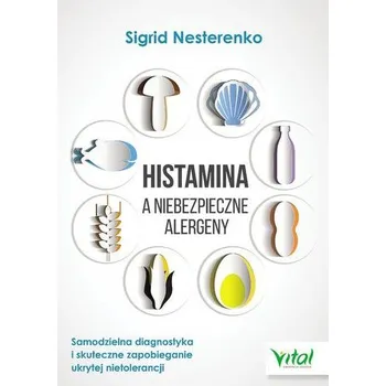 Histamina a niebezpieczne alergeny - Sigrid Nesterenko