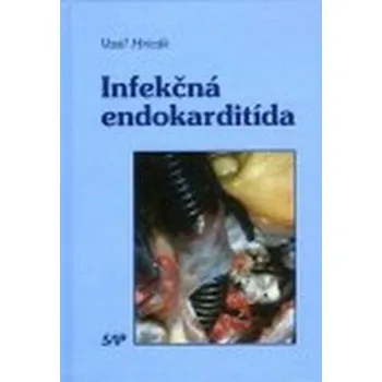 Infekčná endokarditída&nbsp;&nbsp; - Hricák, Vasiľ &nbsp;