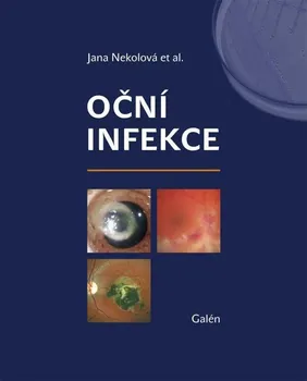 Oční infekce - Jana Nekolová (2021, pevná)