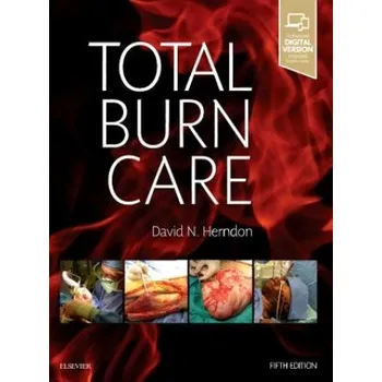 Total Burn Care – Herndon (EN)