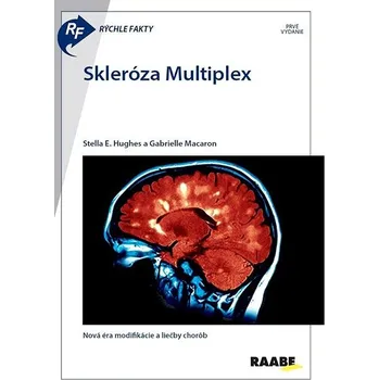 Skleróza Multiplex: Nová éra modifikácie a liečby chorôb Kniha
