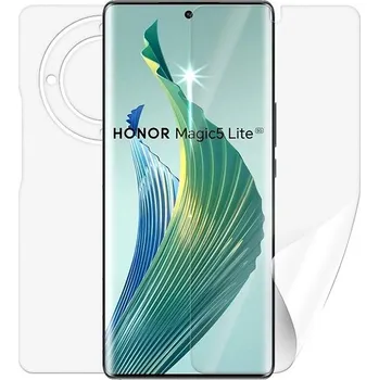 Screenshield HONOR Magic 5 lite 5G fólie na celé tělo