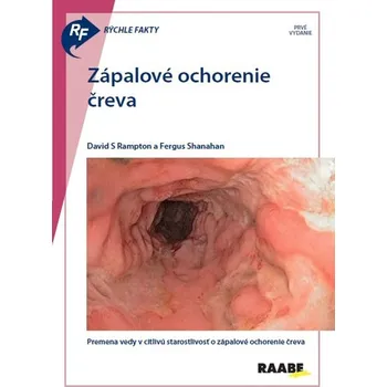 Rýchle fakty: Zápalové ochorenie čreva - David S Rampton, Fergus Shanahan