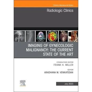 Cizojazyčná kniha Imaging of Gynecologic Malignancy: The Current State of the Art, An Issue of Radiologic Clinics of North America