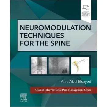 Cizojazyčná kniha Neuromodulation Techniques for the Spine - Abd-Elsayed, Alaa, MD, MBA, MPH, CPE, FASA (University of Wisconsin, USA)