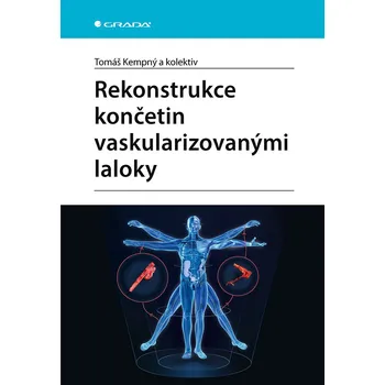 Rekonstrukce končetin vaskularizovanými laloky