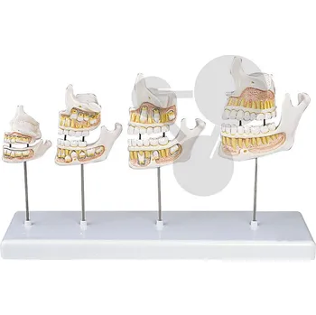 Vývoj zubů Premium