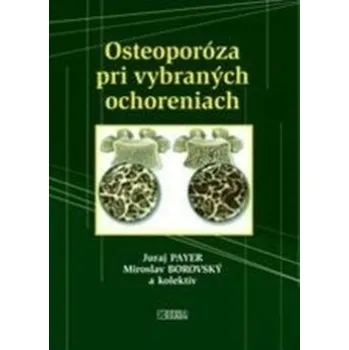 Osteoporóza pri vybraných ochoreniach - Miroslav Borovský a kolektív