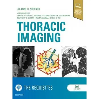 Thoracic Imaging The Requisites – Shepard,Jo-Anne O,MD (EN)