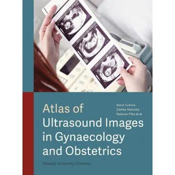 Atlas of Ultrasound Images in Gynaecology and Obstetrics - Turková Marie Malínská Zdeňka Pilka Radovan et al