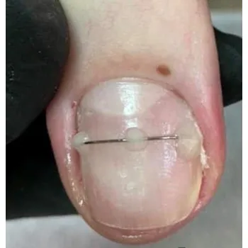 ivoclar Te-Econom Flow 2g A2