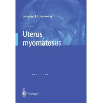 Cizojazyčná kniha Uterus Myomatosus – Johannes F. H. Gauwerky (DE)
