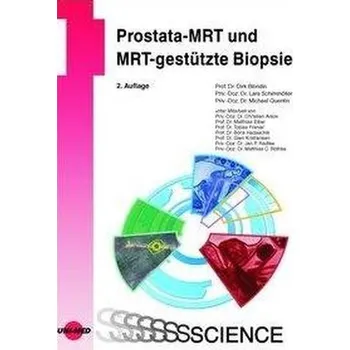 Prostata-MRT und MRT-gestützte Biopsie - Blondin, Dirk [DE] (2020, Vázaná, Uni-Med Verlag Ag)
