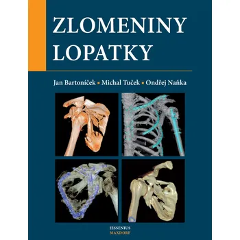 Zlomeniny lopatky - Jan Bartoníček, Ondřej Naňka, Michal Tuček
