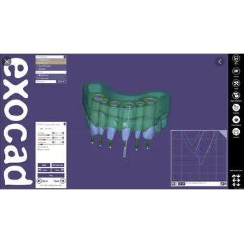 Software Exocad - CAD software Modul: Model creator