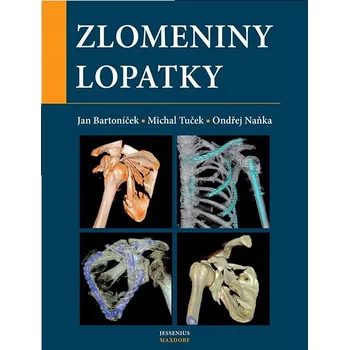 Zlomeniny lopatky Kniha