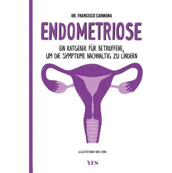 Endometriose - Carmona, Francisco