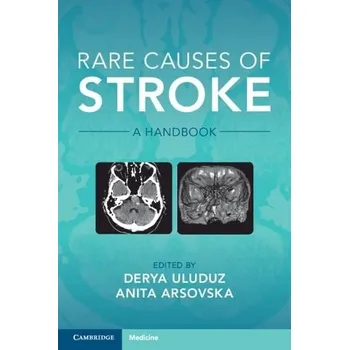 Cizojazyčná kniha Rare Causes of Stroke - Arsovska, Anita