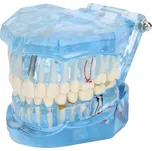 Verk 01964-N model čelisti a zubních…