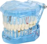 Verk 01964-N model čelisti a zubních…