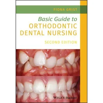 Cizí jazyk Basic Guide to Orthodontic Dental Nursing - Grist, Fiona (Senior Orthodontic Nurse in the Maxillofacial Unit at Worthing Hospital and Vice President of the Orthodontic National Group for Dental Nurses and Therapists)