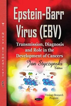 Epstein-Barr Virus (EBV): Transmission, Diagnosis & Role in the Development of Cancers - Jan Styczynski [EN] (2014, pevná)