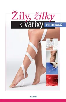 Žíly, žilky, varixy - Peter Baláž (2021, brožovaná)