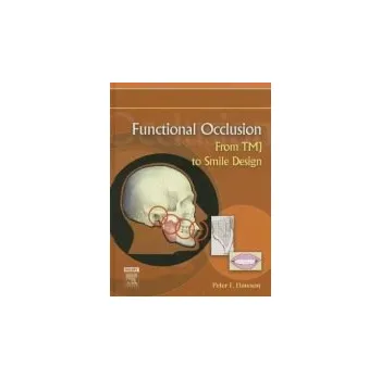 Cizojazyčná kniha Functional Occlusion - Dawson, Peter E.