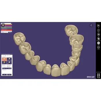Grafický software Exocad - CAD software Modul: Provisional