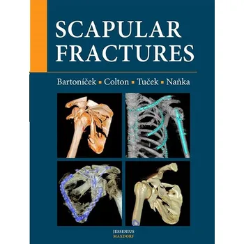 Scapular fractures Kniha