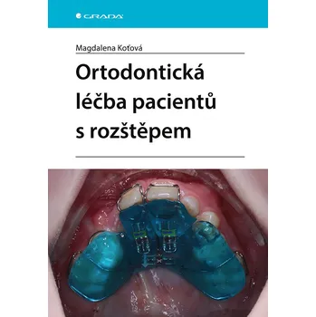 Ortodontická léčba pacientů s rozštěpem