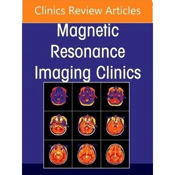 Cizojazyčná kniha MR Imaging of the Adnexa, An Issue of Magnetic Resonance Imaging Clinics of North America