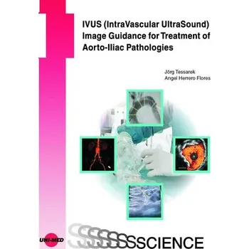 IVUS (IntraVascular UltraSound) Image Guidance for Treatment of Aorto-Iliac Pathologies - Tessarek, Jörg