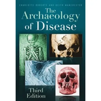 The Archaeology of Disease - Kleiner Art , Roberts Charlotte, Ross Richard B., Senge Peter M., Smith Bryan J.