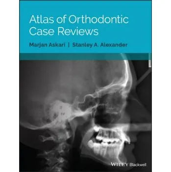 Atlas of Orthodontic Case Reviews – Marjan Askari,Stanley A. Alexander (EN)