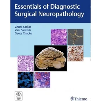Essentials of Diagnostic Surgical Neuropathology – Chitra Sarkar,Vani Santosh,Geeta Chacko (EN)