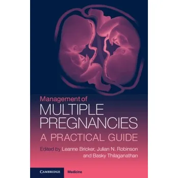 Management of Multiple Pregnancies