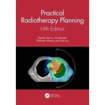 Practical Radiotherapy Planning - Morris, Gloria; Croft, Stephen