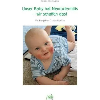 Unser Baby hat Neurodermitis - wir schaffen das! - Kuppe, Friederike