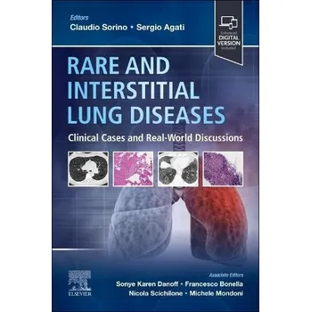 Cizojazyčná kniha Rare and Interstitial Lung Diseases