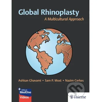 Cizojazyčná kniha Global Rhinoplasty - Ashkan Ghavami, Nazim Cerkes, Sam P. Most Georg Thieme Verlag