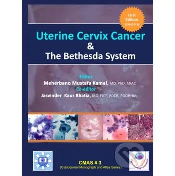 Uterine Cervix Cancer The Bethesda System - Meherbano Mustafa Kamal Independently