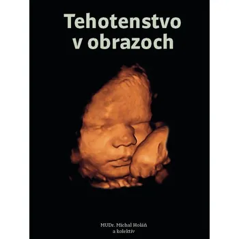 Umění Tehotenstvo v obrazoch