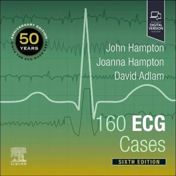 Cizojazyčná kniha 160 ECG Cases - Hampton, John (Emeritus Professor of Cardiology, University of Nottingham, UK) a Hampton, Joanna, MD, MA, BM, BCh, FRCP (Consultant Physician, Addenbrooke's Hospital, Cambridge, UK) a Adlam, David (Professor of Acute and Interventional Car