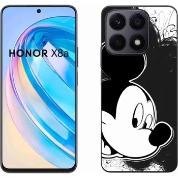 Pouzdro na mobilní telefon Gelový kryt mmCase na Honor X8a - mickey mouse 1